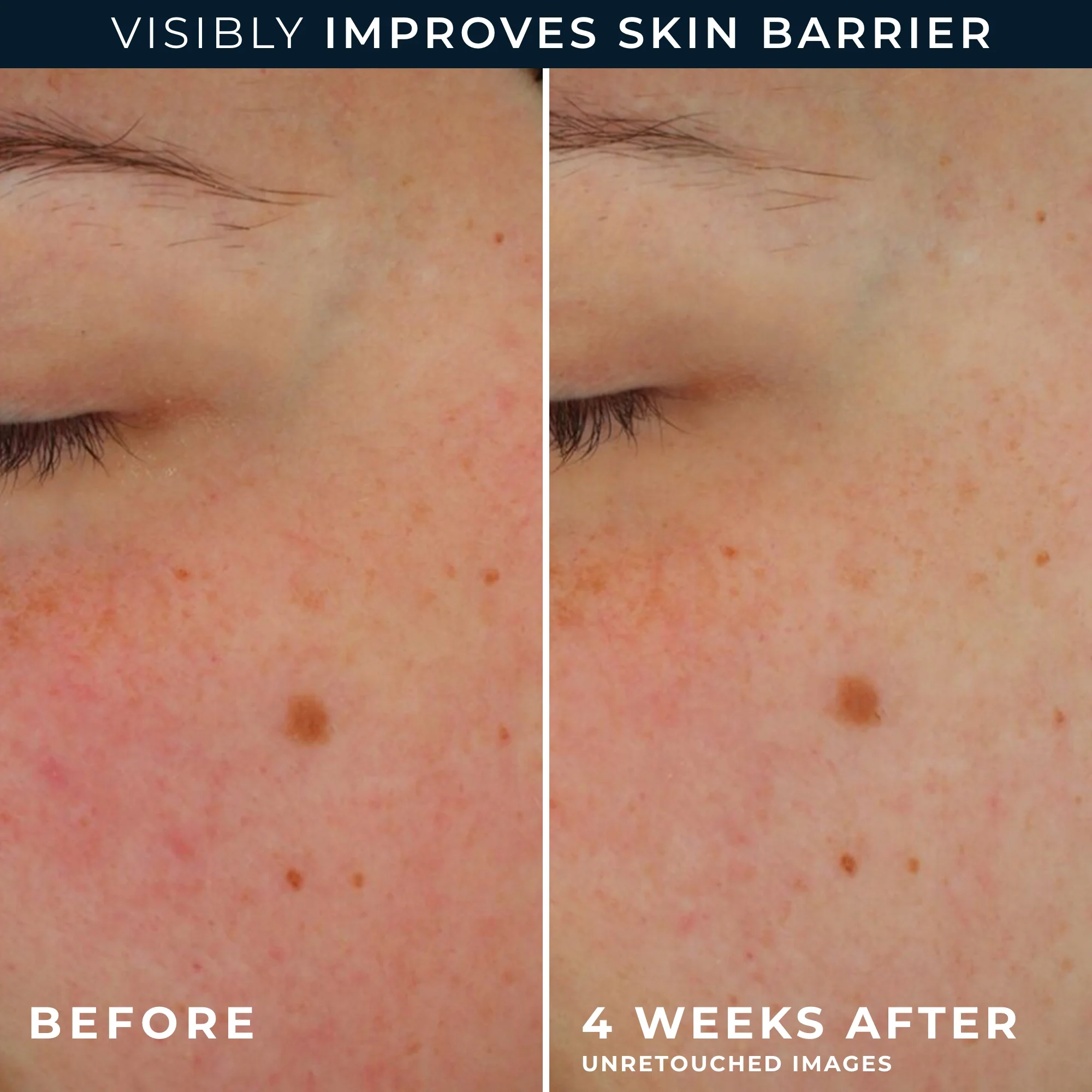 Barrier Renew® AM Moisturizer SPF 30 - Image 5
