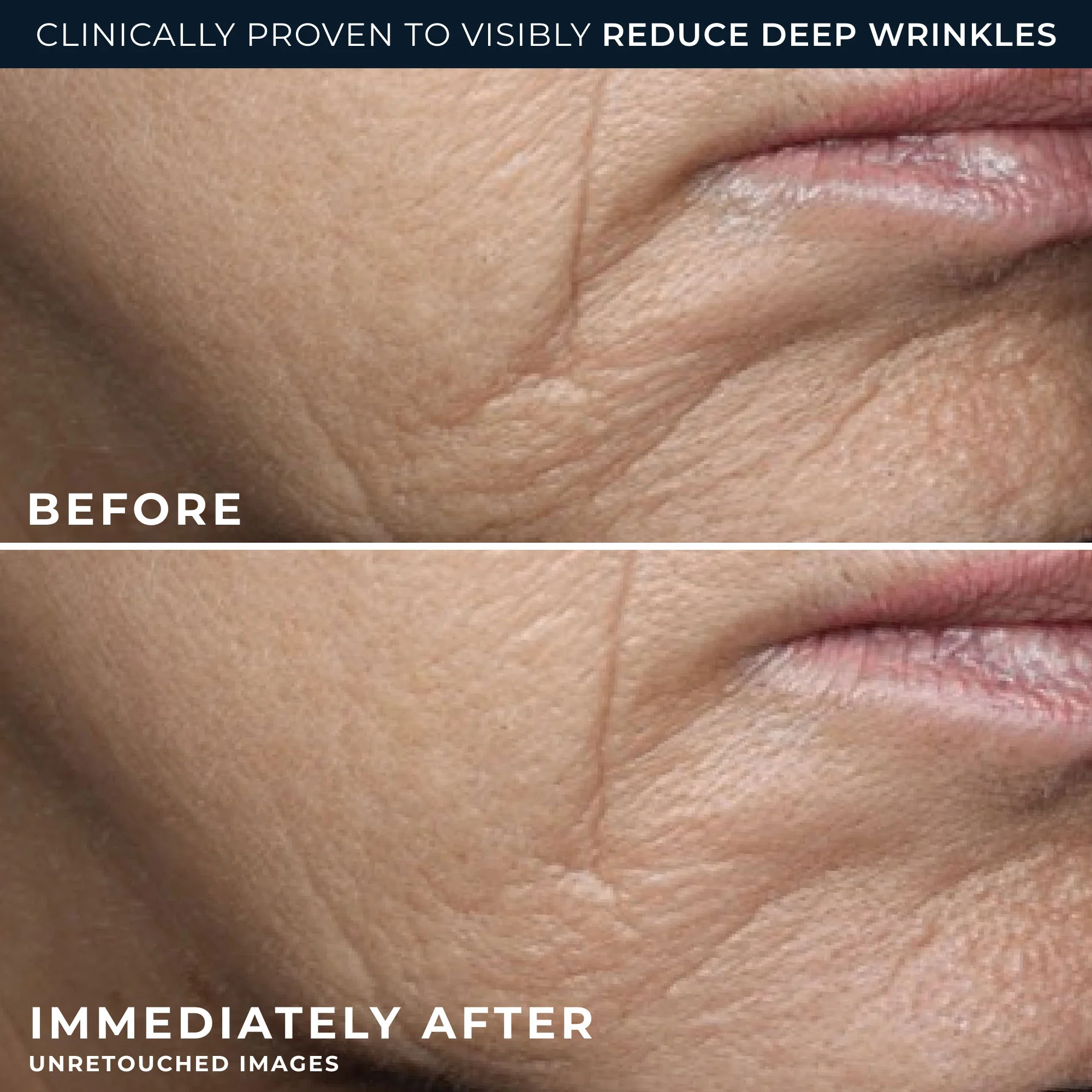 RETINOL CORREXION® Deep Wrinkle Rich Cream - Image 4