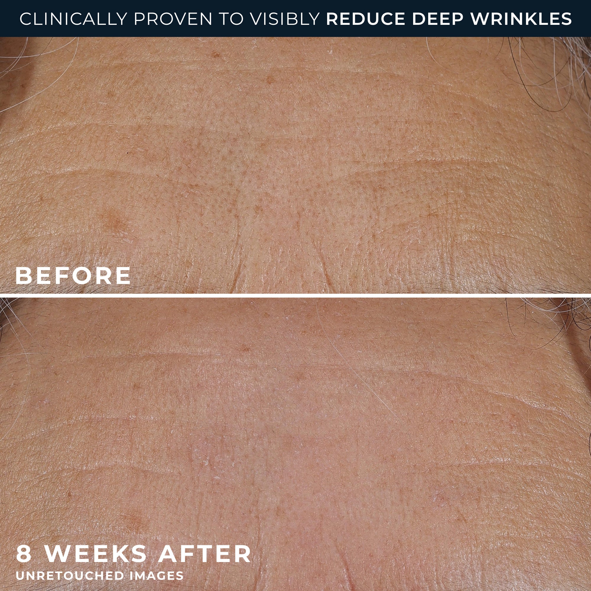 RETINOL CORREXION® Deep Wrinkle Rich Cream - Image 5