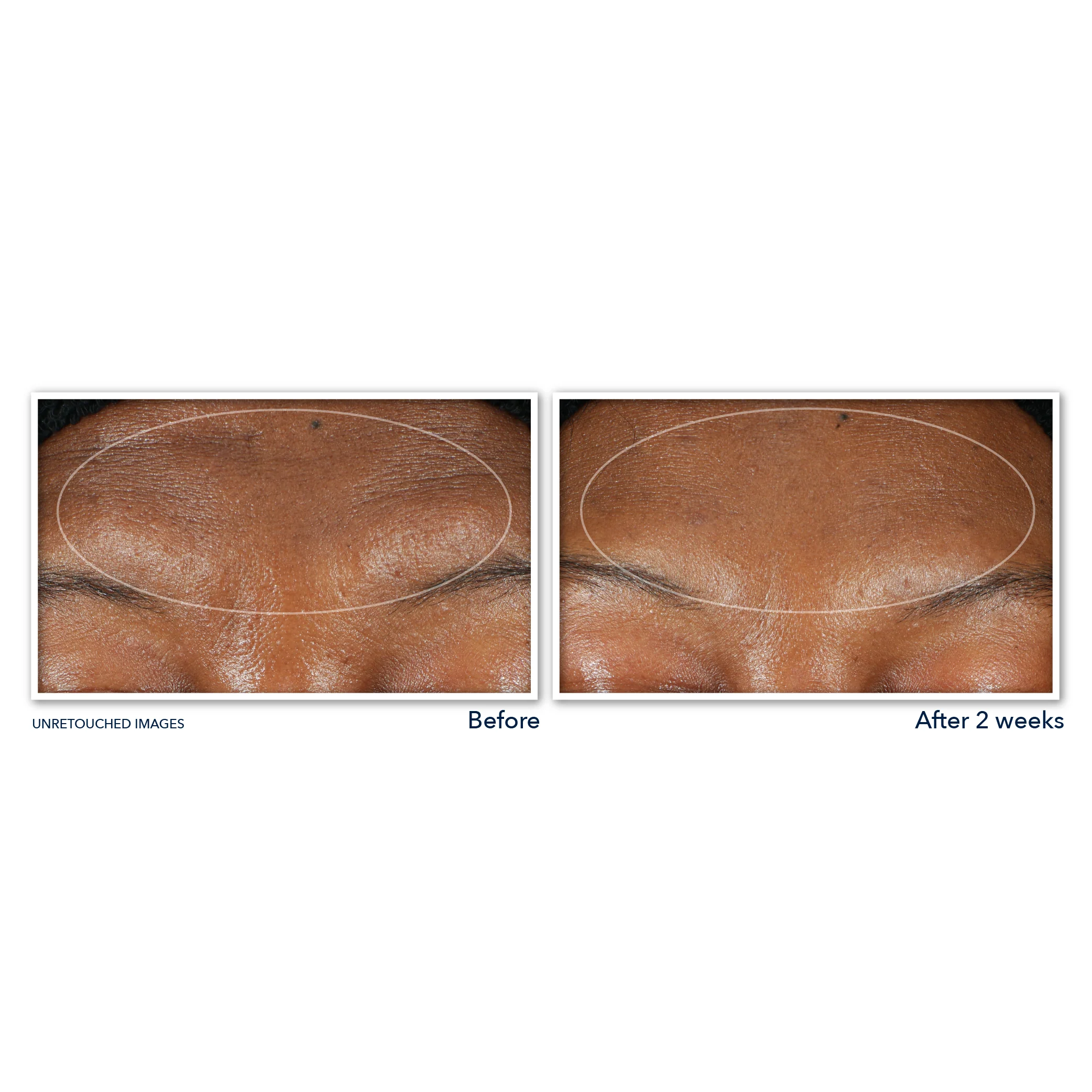 DERM CORREXION® Serum Cleanser - Image 4