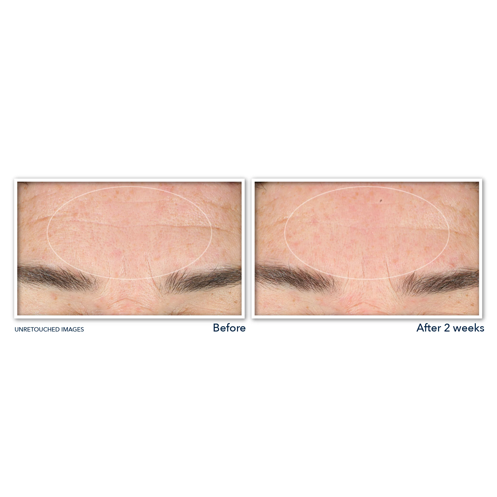 DERM CORREXION® Serum Cleanser - Image 5