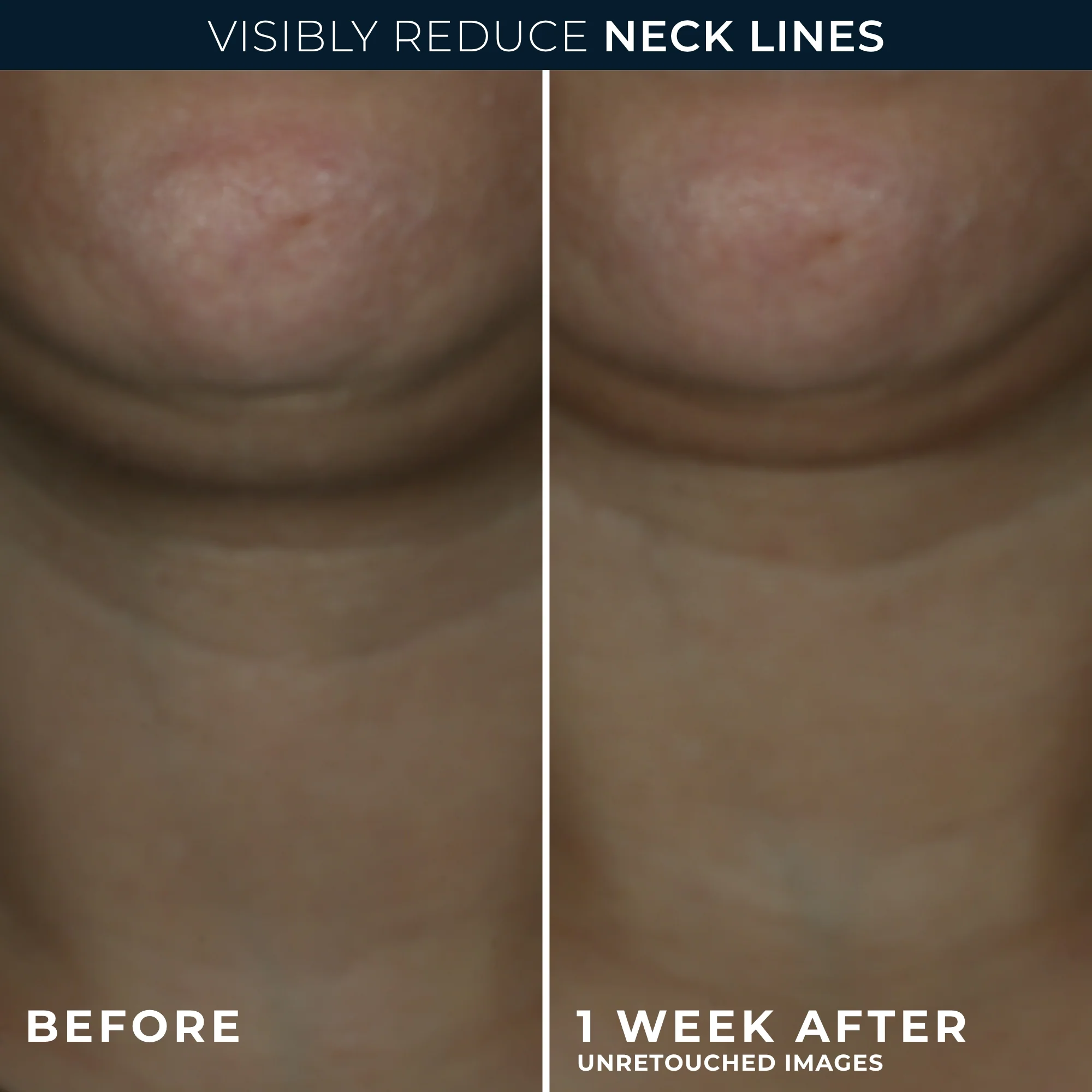 DERM CORREXION® Contour Cream - Image 5