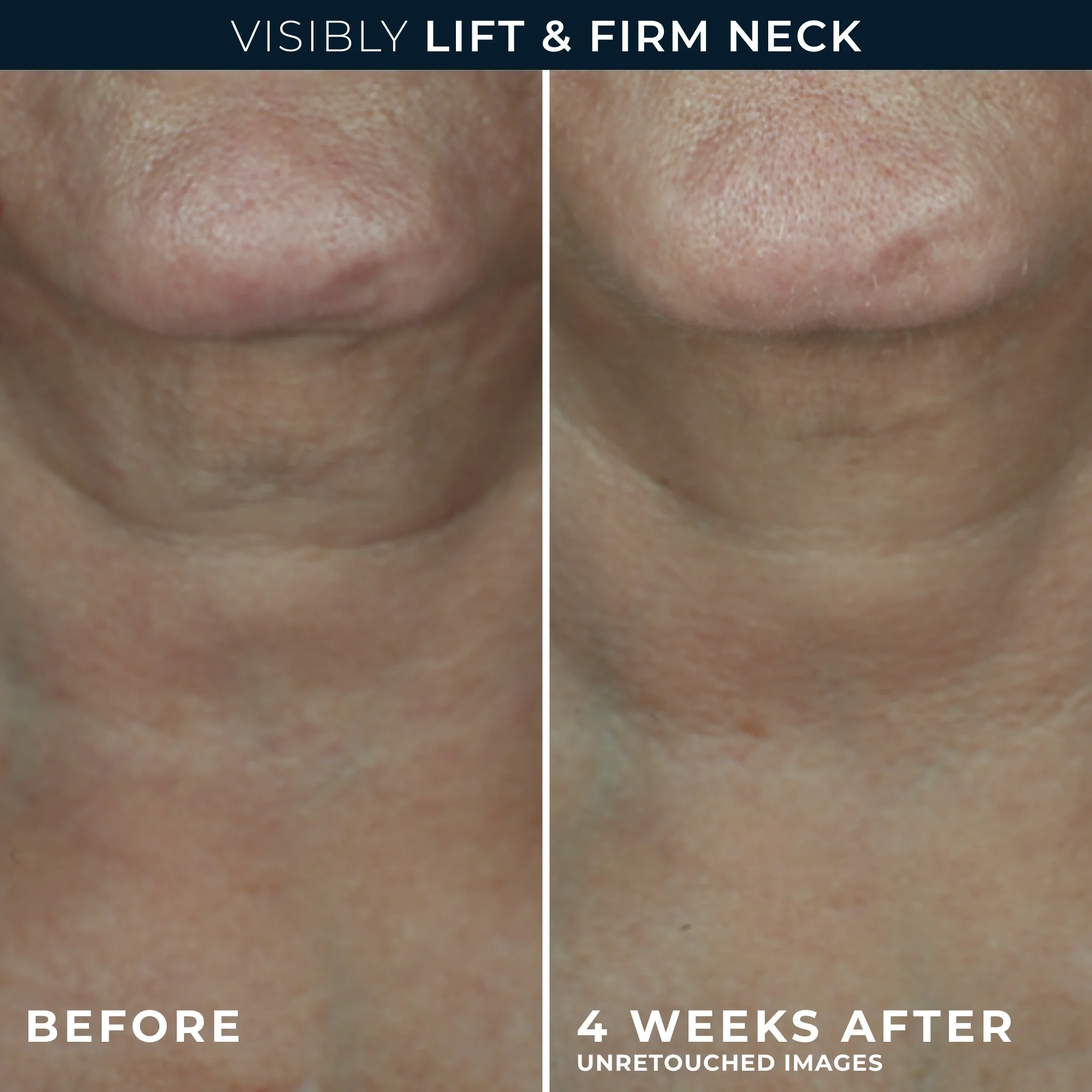 DERM CORREXION® Contour Cream - Image 6
