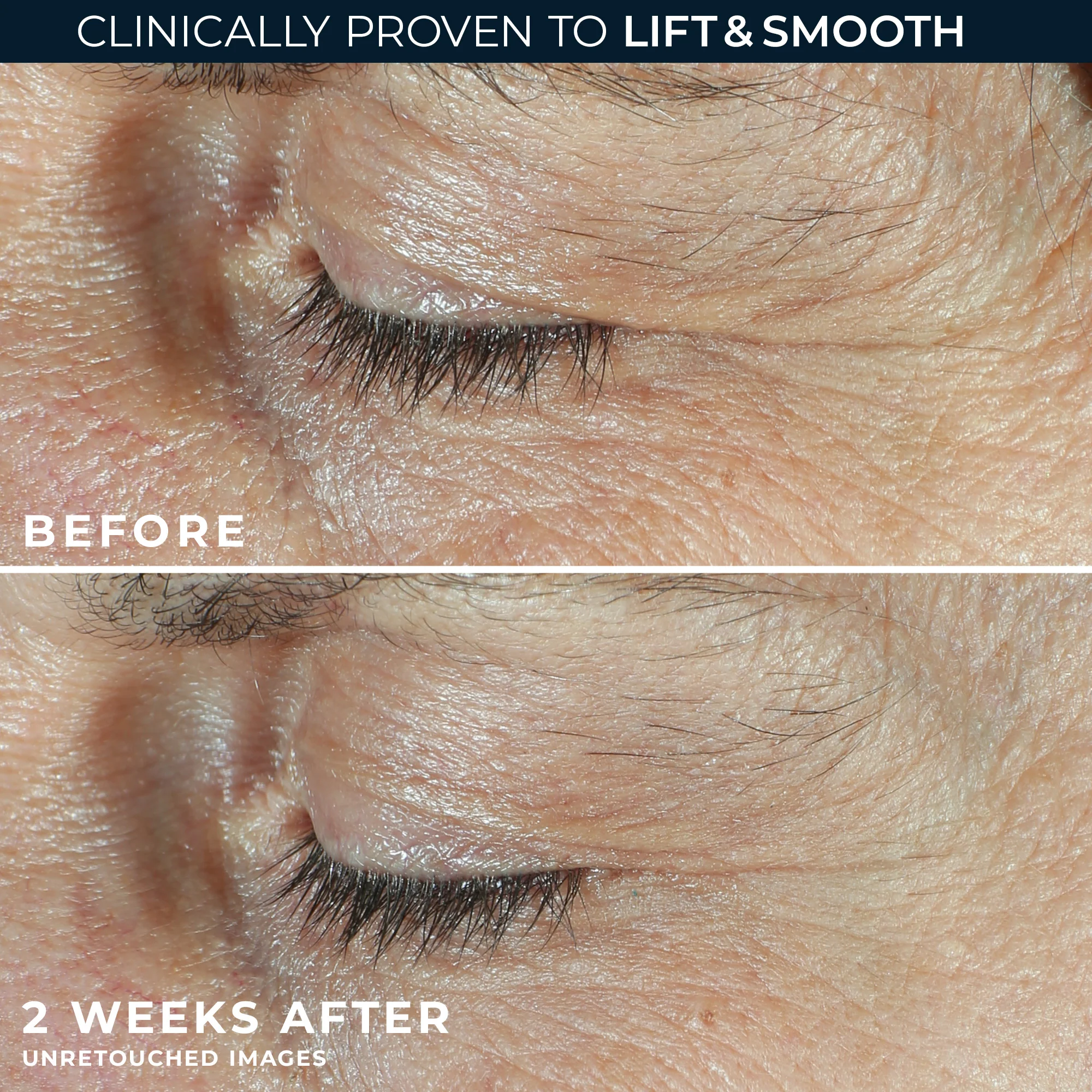 DERM CORREXION® Dual Eye Cream - Image 3