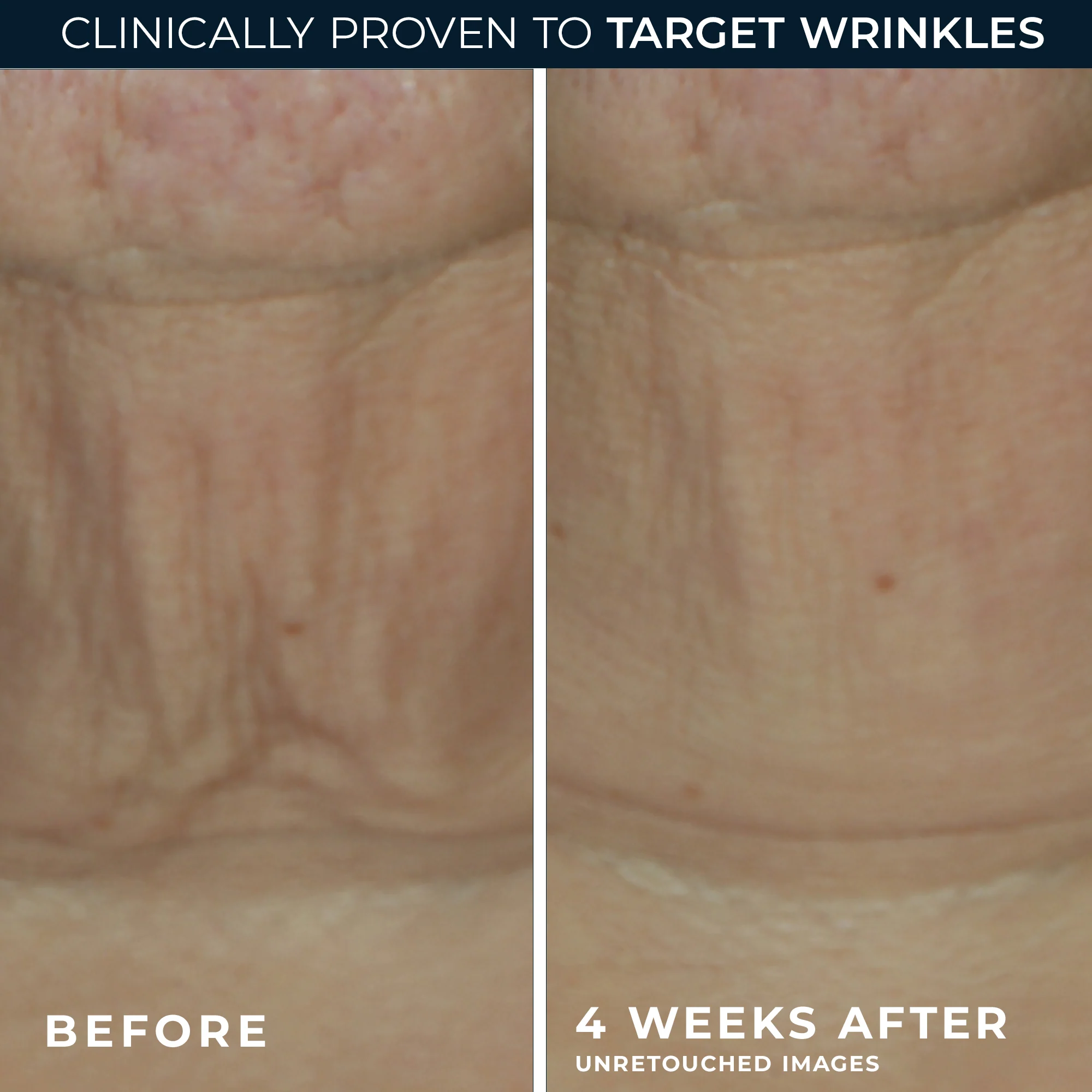 DERM CORREXION® Firming Serum Stick - Image 5