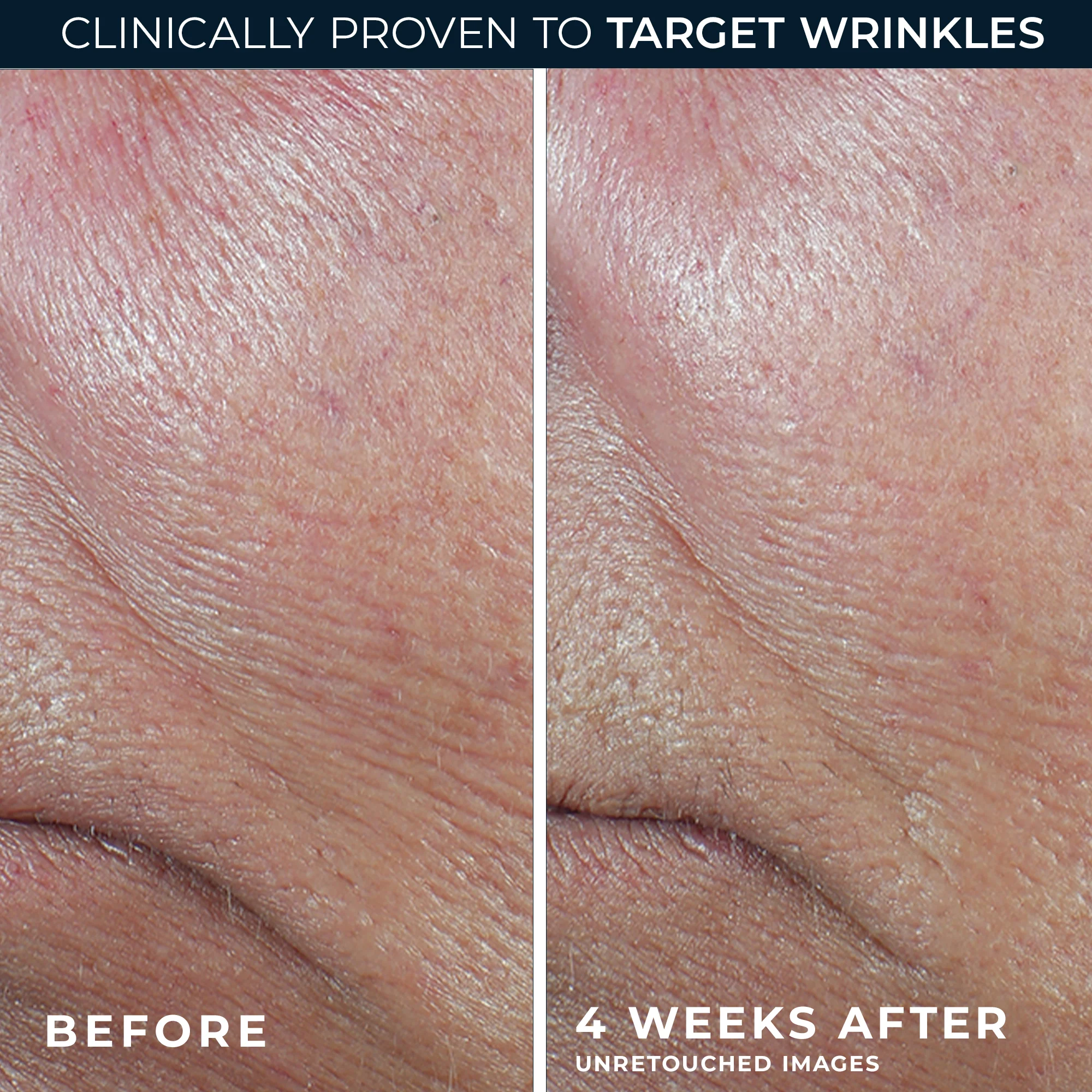 DERM CORREXION® Firming Serum Stick - Image 7