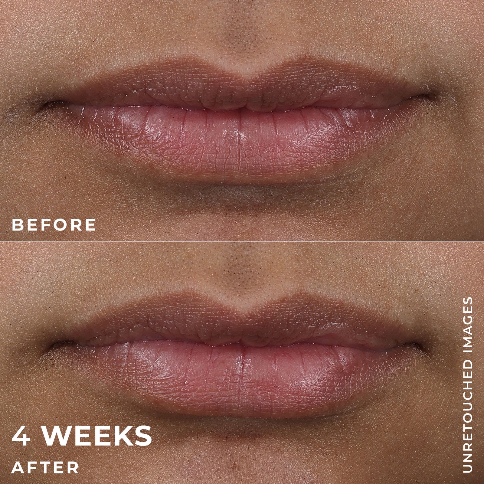 DERM CORREXION® Lip Volumizer - Image 7