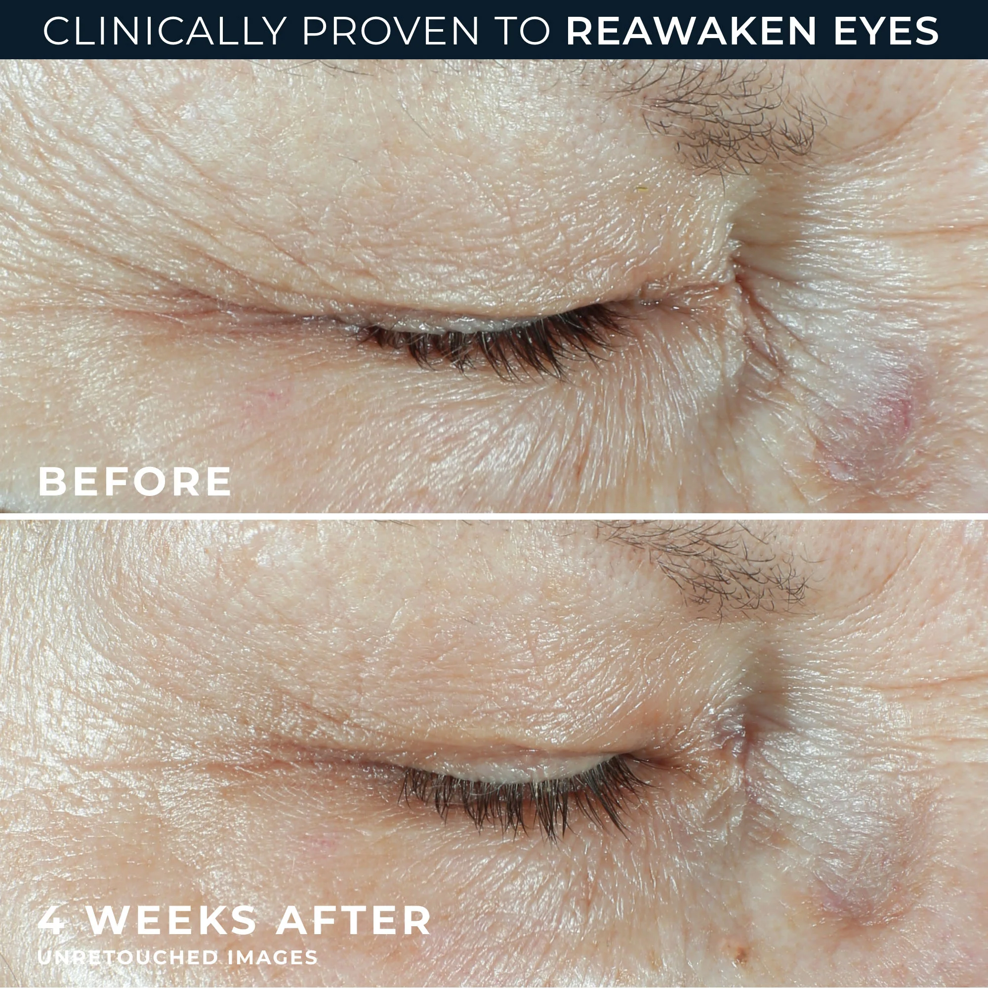 Hydration+ Eye Cream - Image 4