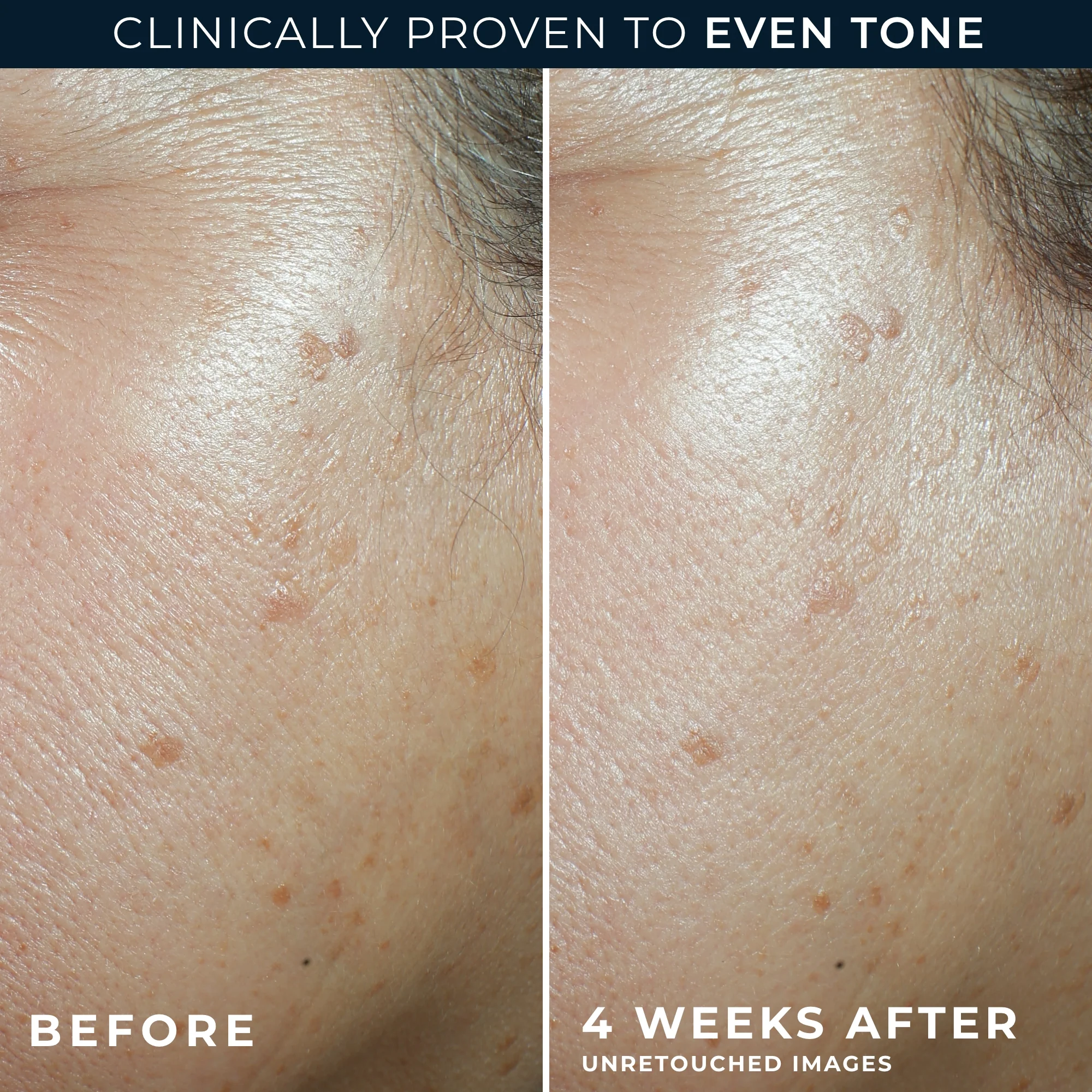 MULTI CORREXION® Even Tone + Lift Daily Moisturizer SPF 30 - Image 5