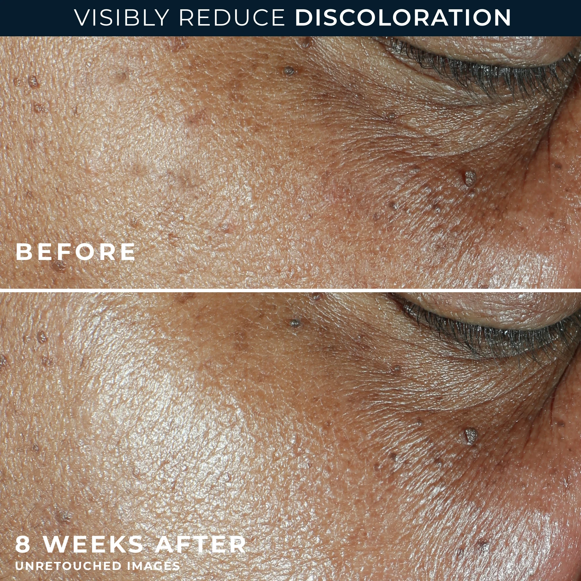 MULTI CORREXION® Even Tone + Lift Daily Moisturizer SPF 30 - Image 6