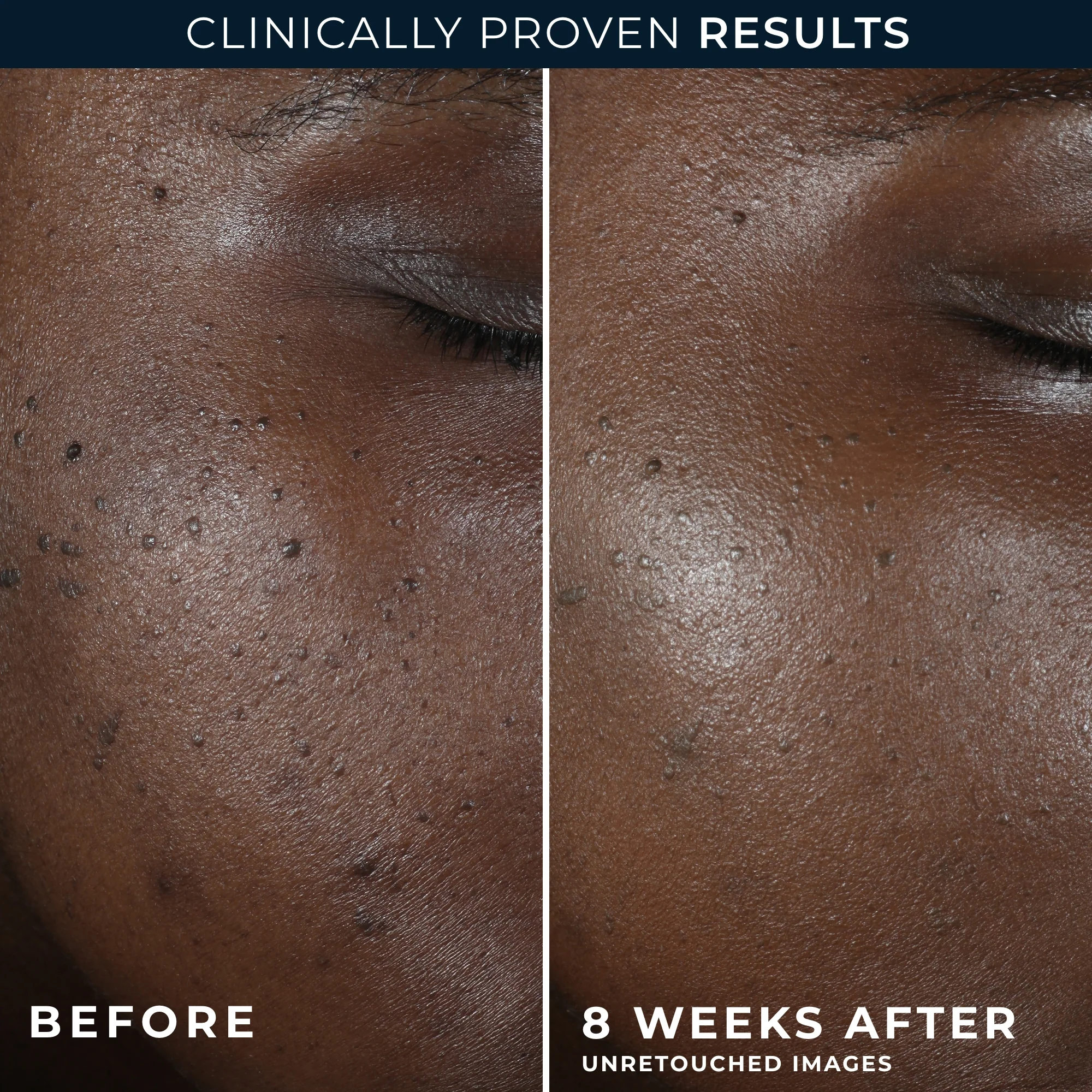 MULTI CORREXION® Even Tone + Lift Night Cream - Image 5