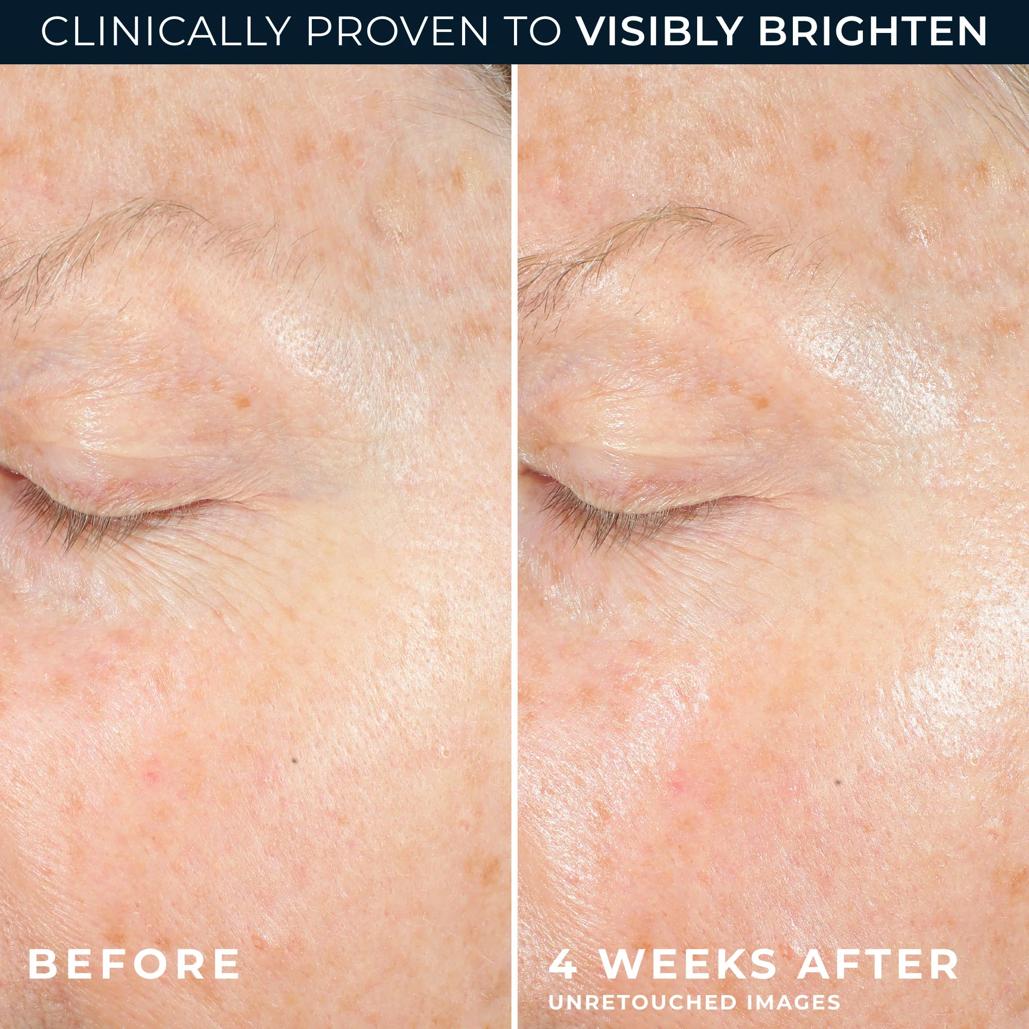MULTI CORREXION® Revive + Glow Moisturizer - Image 5