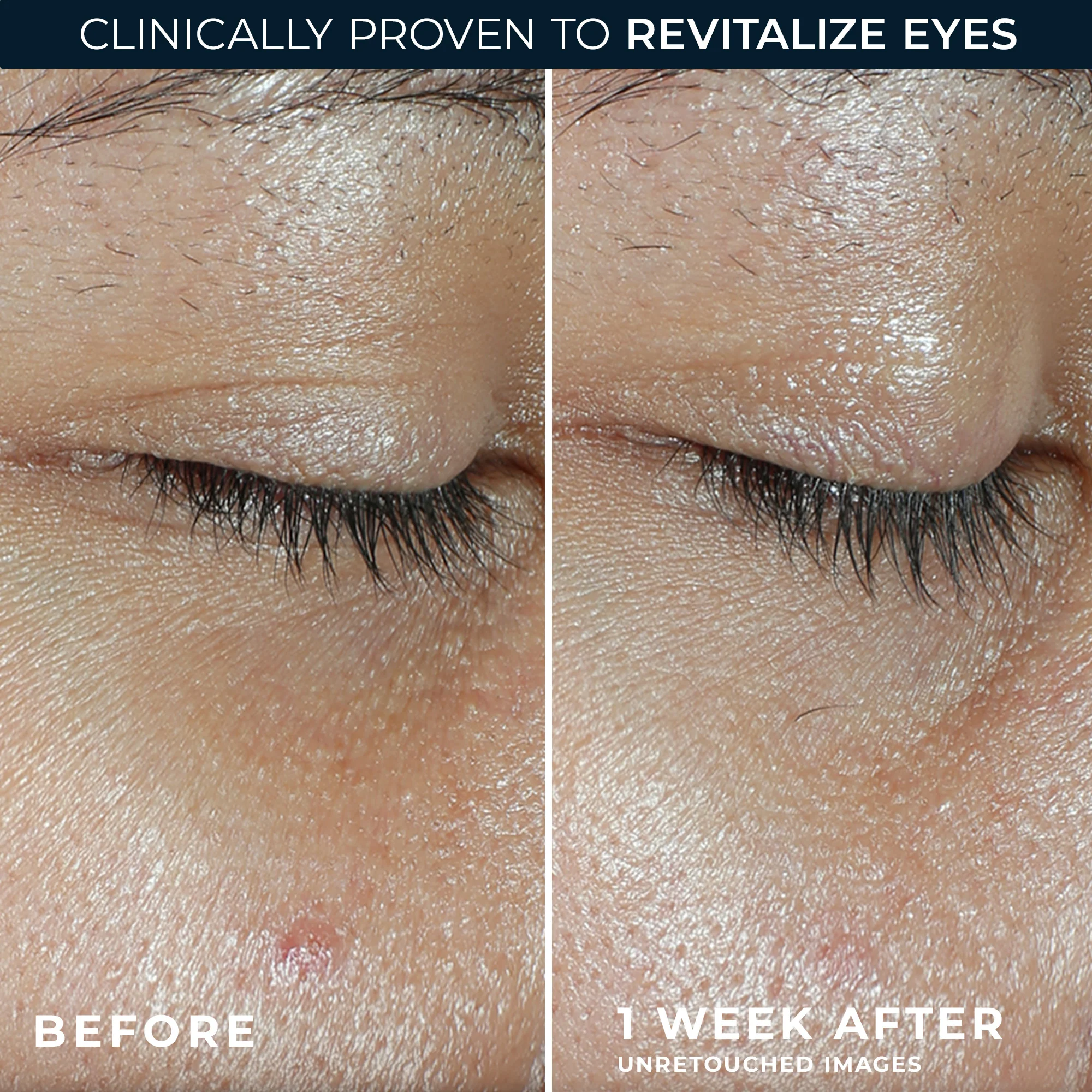 MULTI CORREXION® Revive + Glow Eye Balm - Image 4