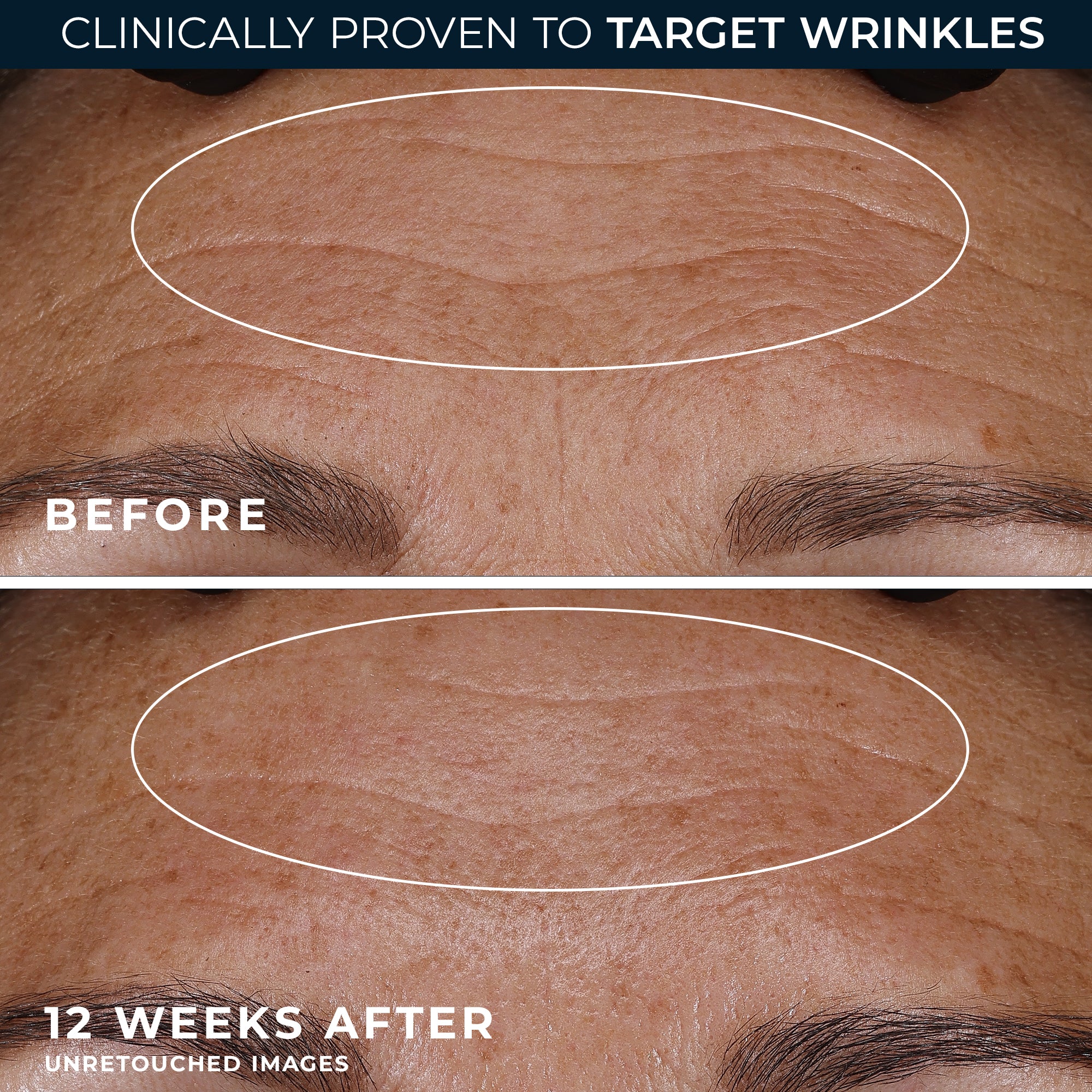 RETINOL CORREXION® Deep Wrinkle Night Cream - Image 5