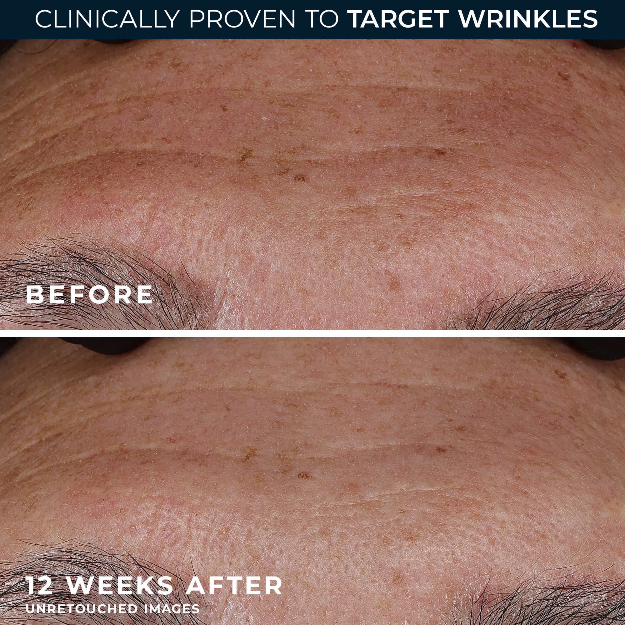 RETINOL CORREXION® Deep Wrinkle Serum - Image 6