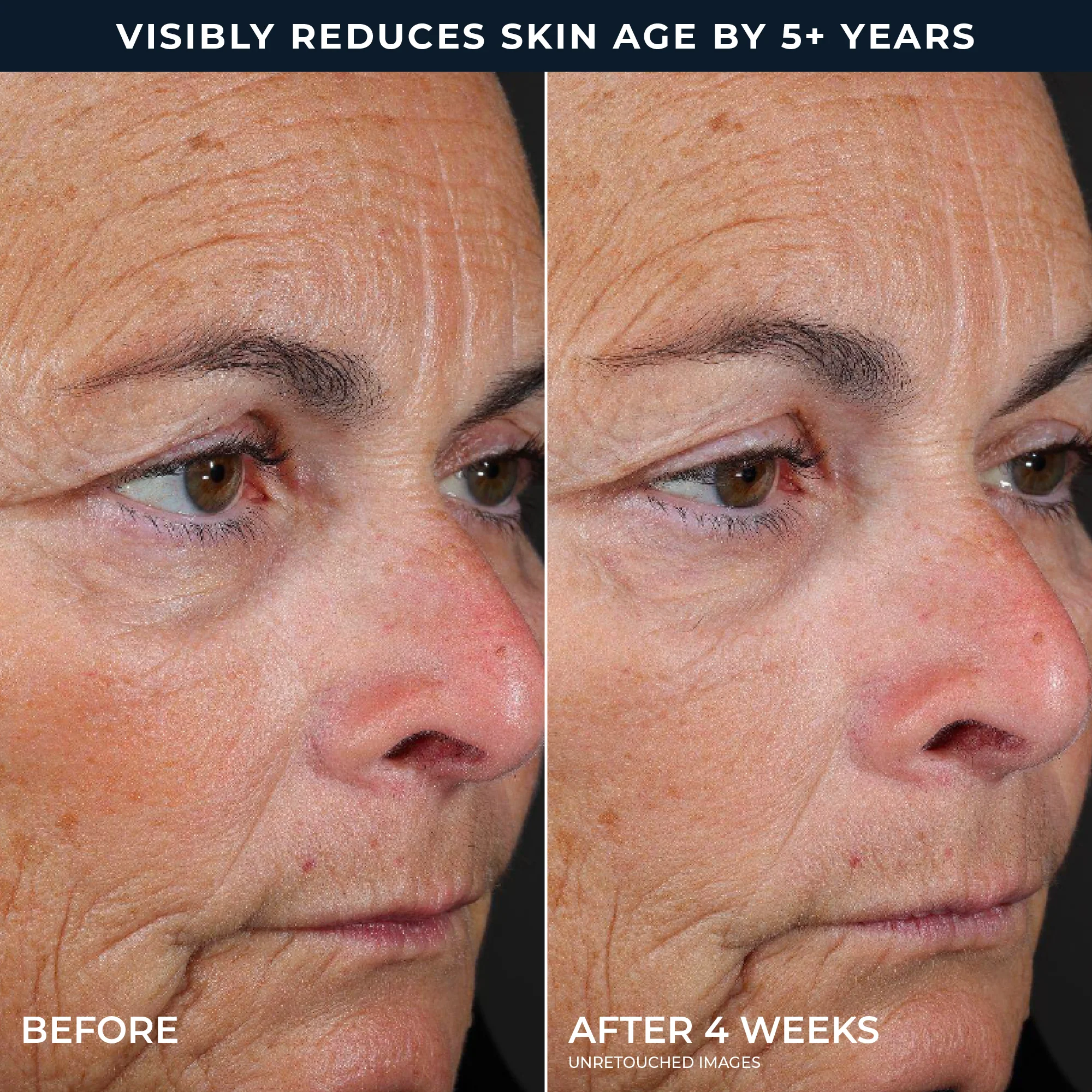 RETINOL CORREXION® Line Smoothing 2-Step Peel Pads - Image 5