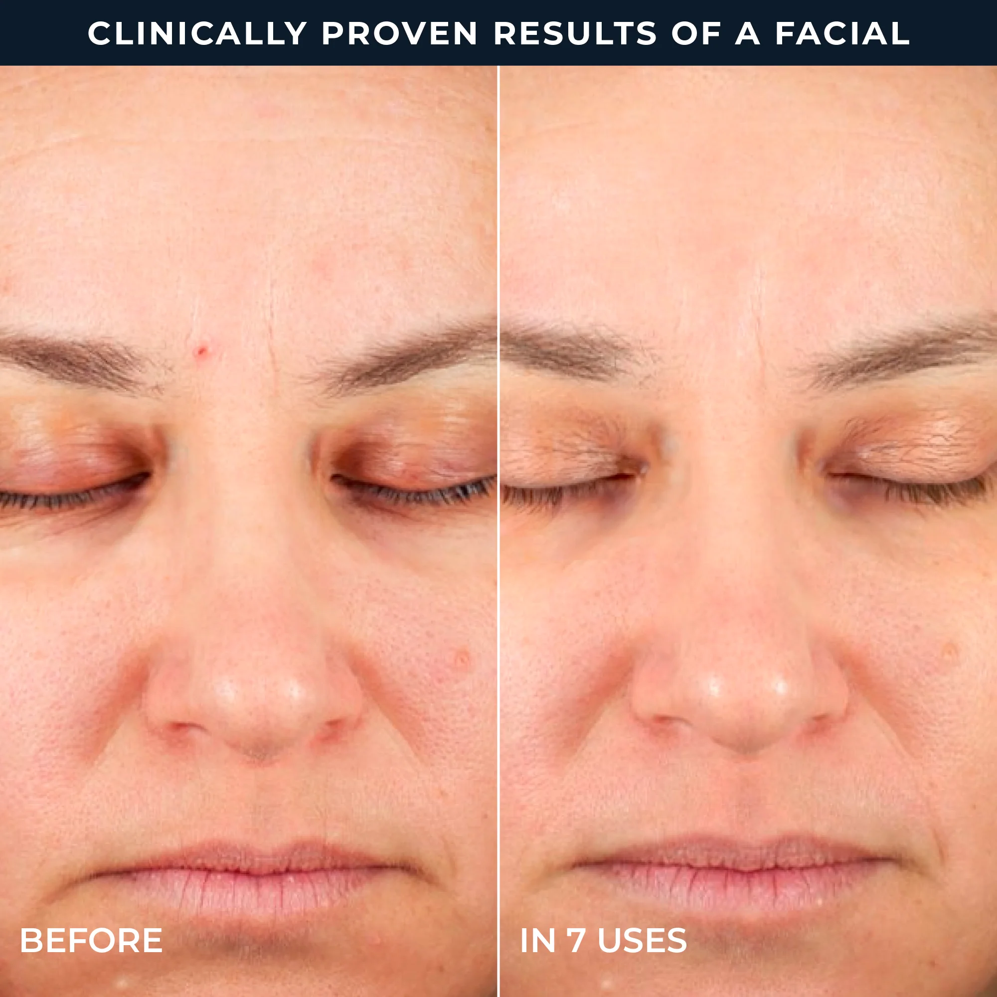 RETINOL CORREXION® Line Smoothing 2-Step Peel Pads - Image 6