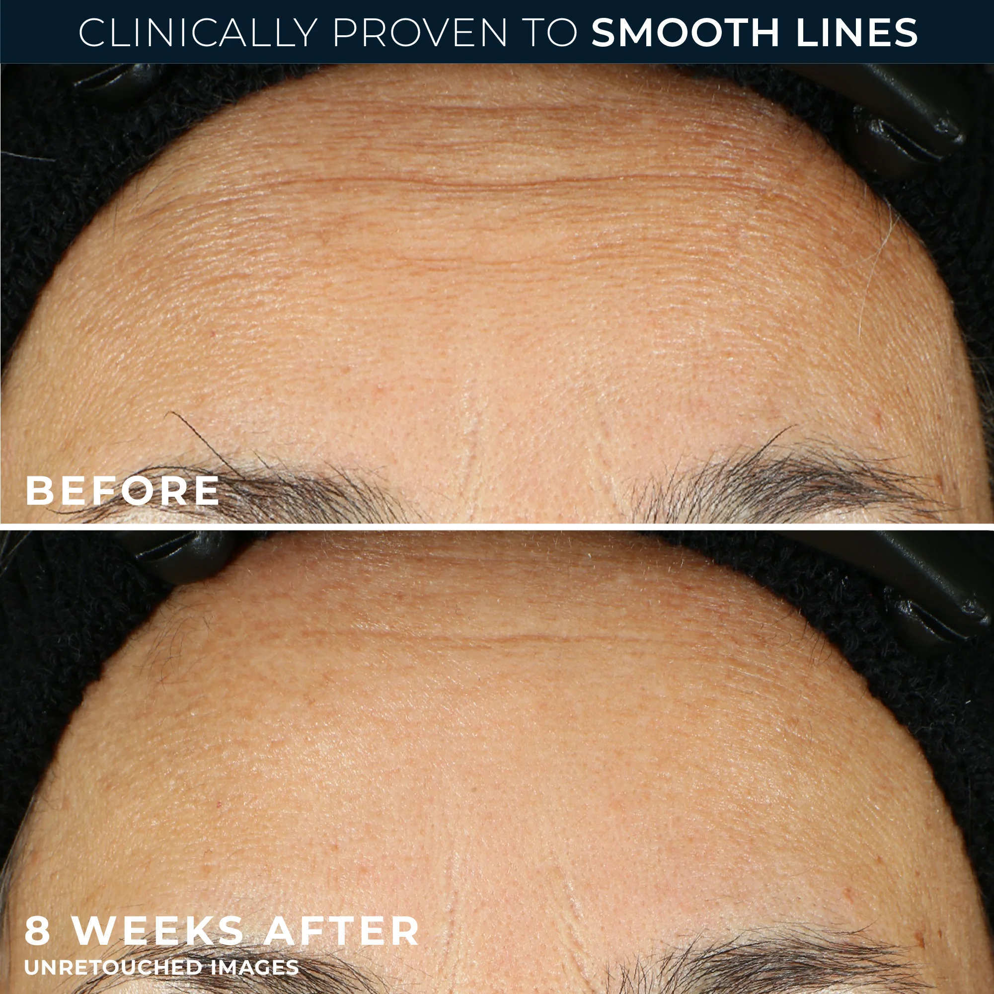RETINOL CORREXION® Line Smoothing Night Serum Capsules - Image 4