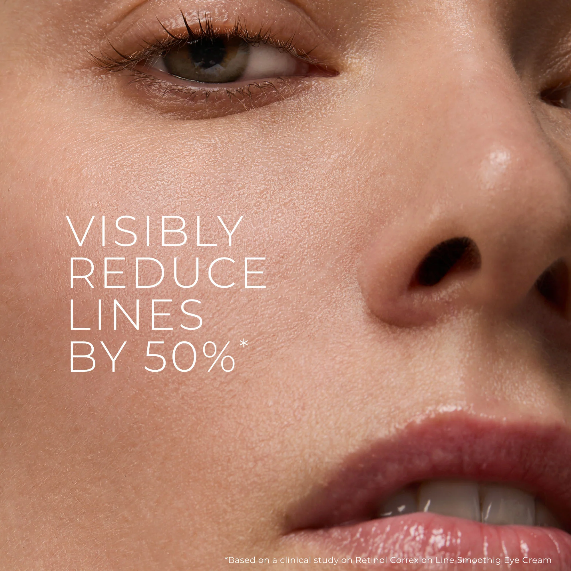 Pure RoC® Retinol Starter Set - Image 2