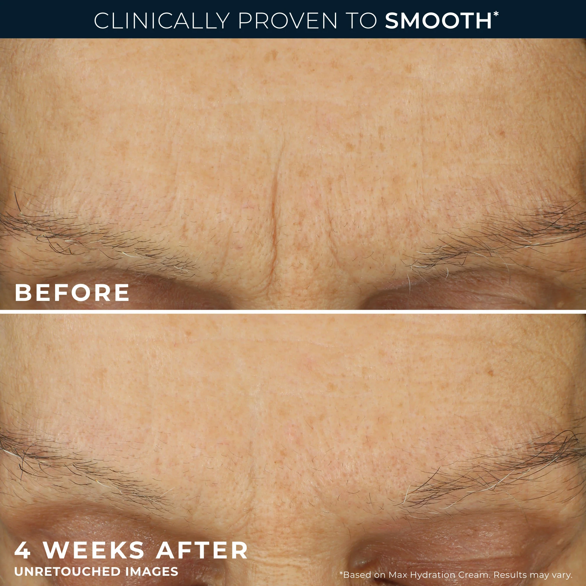Pure RoC® Retinol Starter Set - Image 4